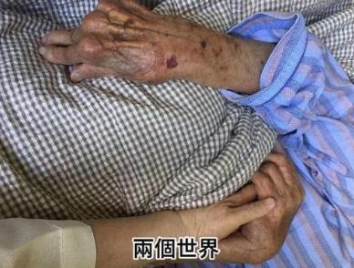 平鑫涛前妻林婉珍__琼瑶平鑫涛鼻管